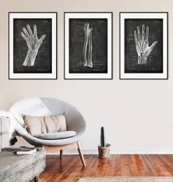 Codex Anatomicus Hands & Legs^Blood vessels of hand - Chalkboard
