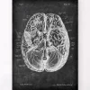 Codex Anatomicus Brain Anatomy^Brain anatomy I - Chalkboard