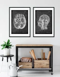 Codex Anatomicus Brain Anatomy^Brain anatomy I - Chalkboard
