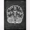 Codex Anatomicus Brain Anatomy^Brain cross section - Chalkboard