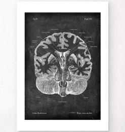Codex Anatomicus Brain Anatomy^Brain cross section - Chalkboard