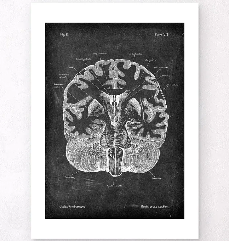 Codex Anatomicus Brain Anatomy^Brain cross section - Chalkboard