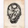 Codex Anatomicus Obstetrics & Gynecology^Fetus in a womb anatomy print II