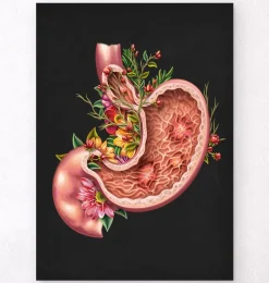 Codex Anatomicus Digestive System^Gastric ulcers - Floral - Black