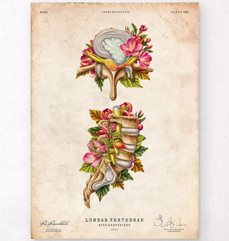 Codex Anatomicus Skull & Skeleton^Herniated disc - Floral - Vintage