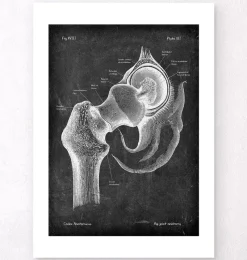 Codex Anatomicus Skull & Skeleton^Hip joint anatomy - Chalkboard