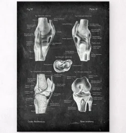 Codex Anatomicus Hands & Legs^Knee anatomy chart - Chalkboard