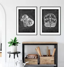 Codex Anatomicus Brain Anatomy^Medulla oblongata - Chalkboard