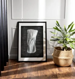 Codex Anatomicus Hands & Legs^Popliteal fossa - Chalkboard