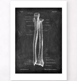 Codex Anatomicus Skull & Skeleton | Hands & Legs^Ulna & Radius - Chalkboard